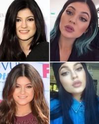 kylie jenner lip challenge