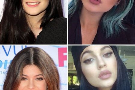 Kylie Jenner Lip Challenge: Kylie Jenner reage