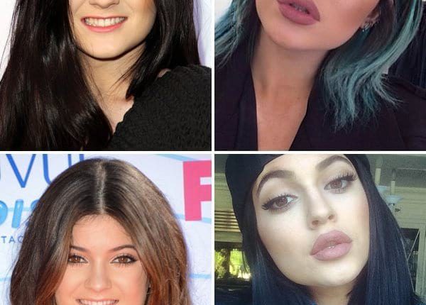 kylie jenner lip challenge